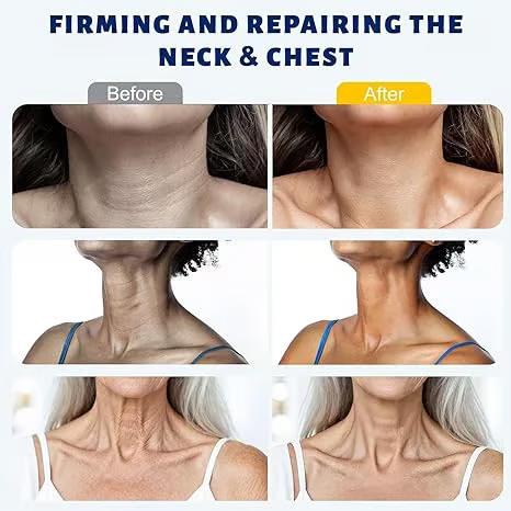 Roller Massage Neck Cream 🧴 Collagen & Hyaluronic Acid | Firms Neck, Reduces Wrinkles & Double Chin